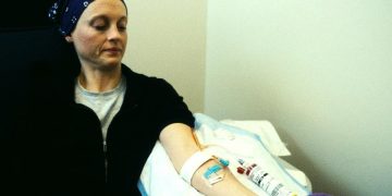 Chemotherapy