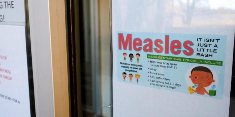 Measles
